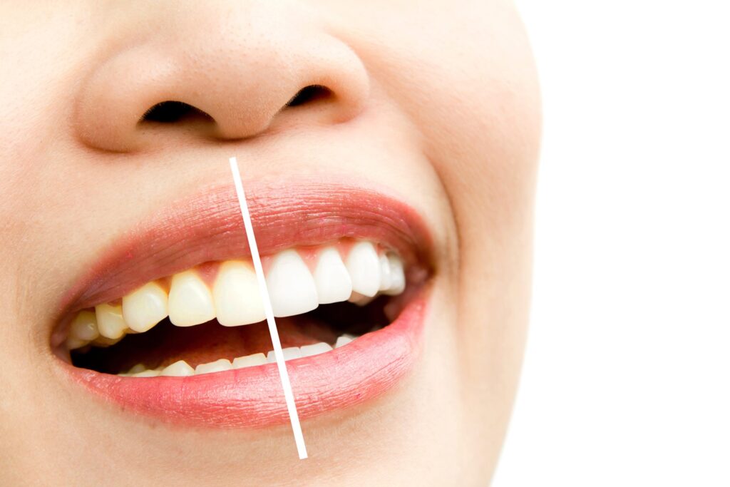 THC Dental Centre, Dr. Meher